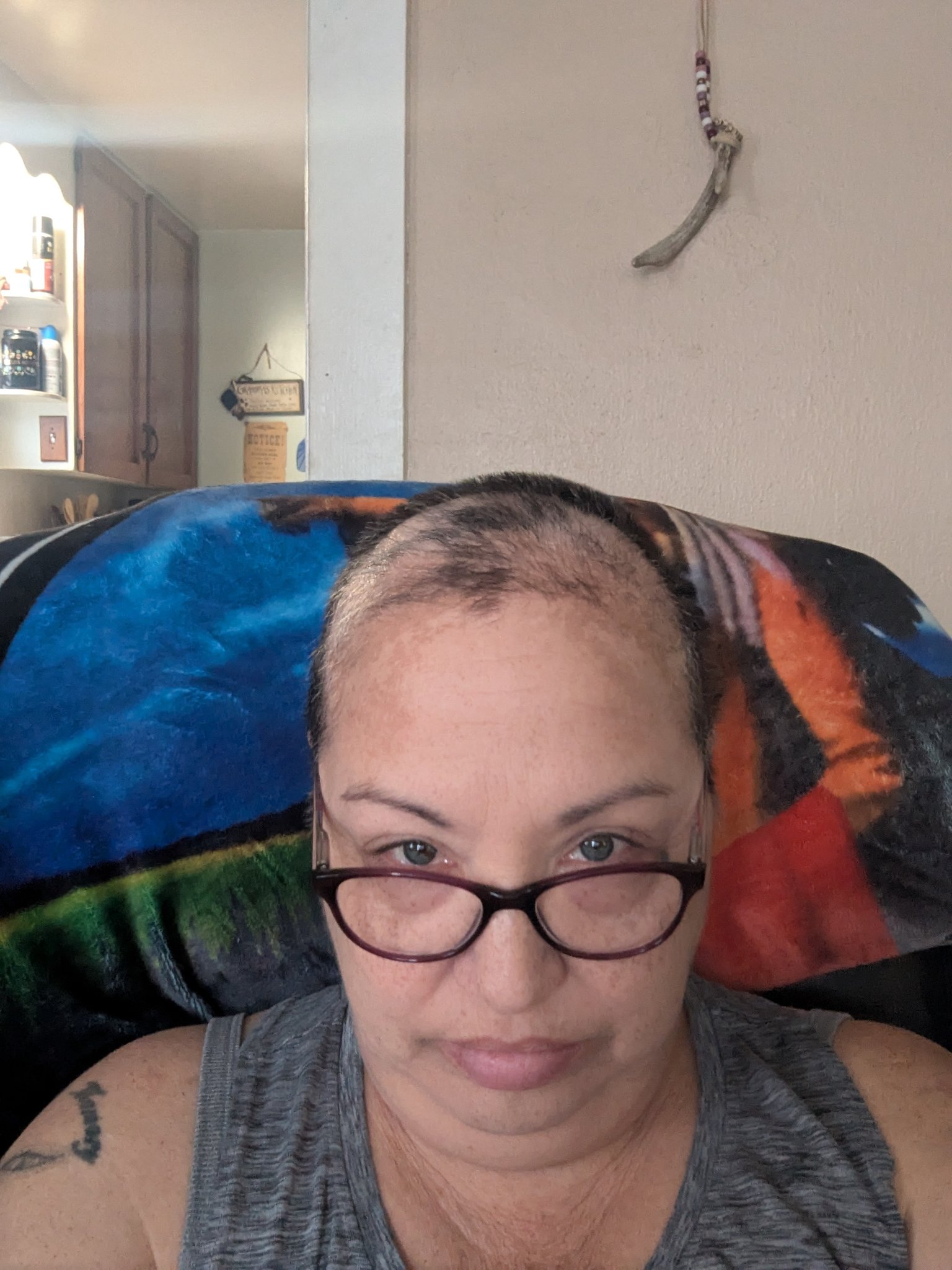 Vicki Solis - Here's a lil update for y'all!! Chemo is... | Facebook