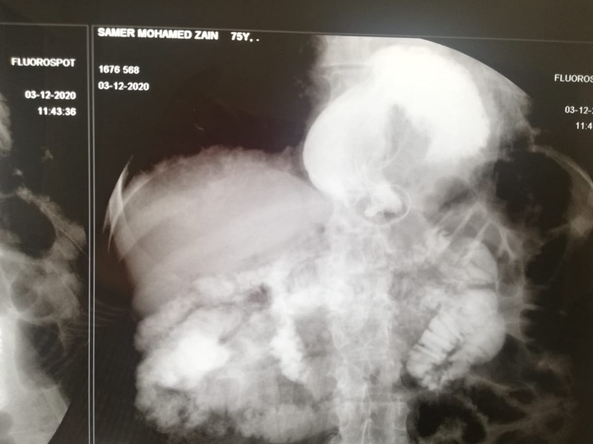 Conventional Radiography
