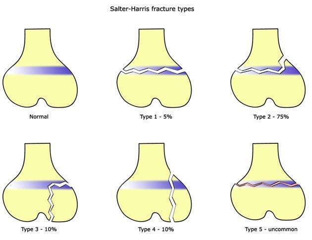 Dr. - SALTR - a useful mnemonic to help remember the five types of ...