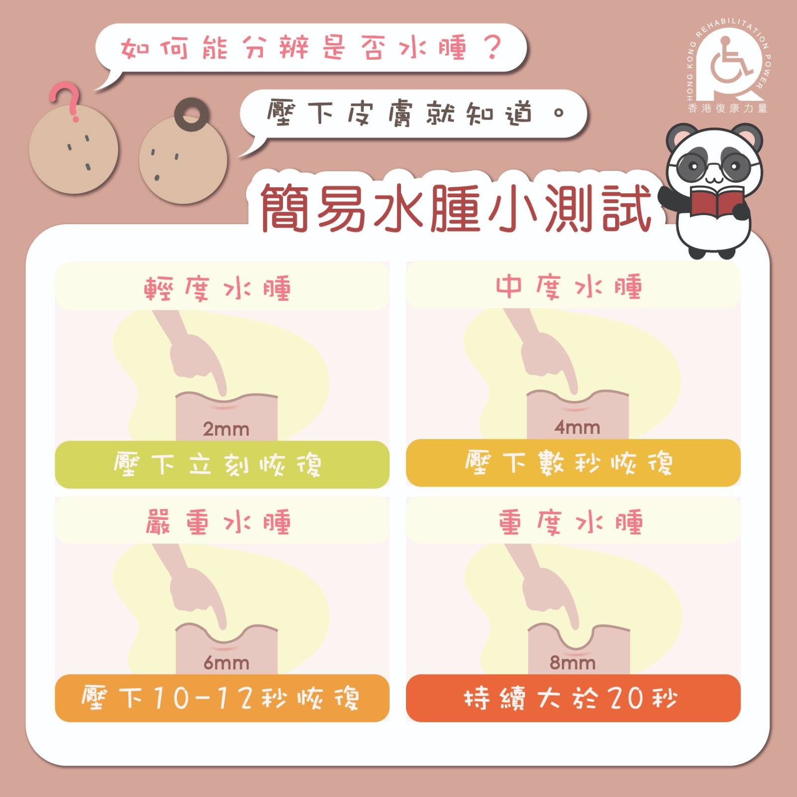 香港復康力量 - 怎樣知道有無水腫 原來簡單壓一下皮膚，就可以測試到水腫的情況。 #HKRP #香港復康力量...