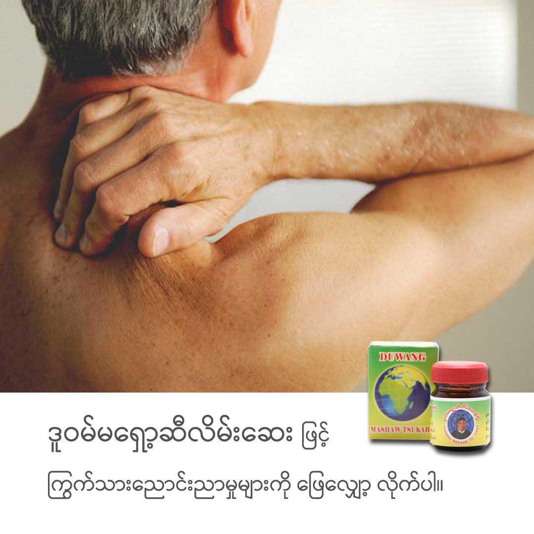 DuWang Traditional Mashaw Balm - ဒူဝမ်မရှော့ဆီလိမ်းဆေး | Mandale