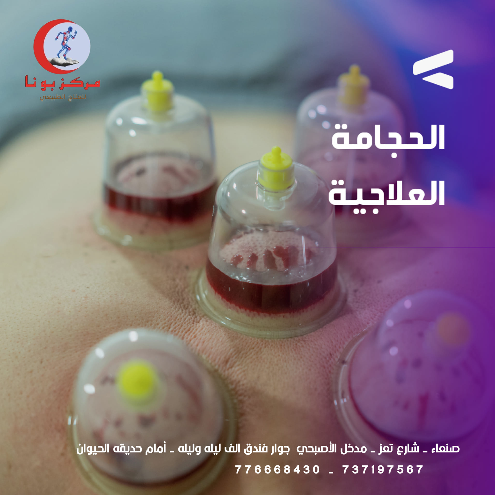مركز بونا للعلاج الطبيعي | Sanaa
