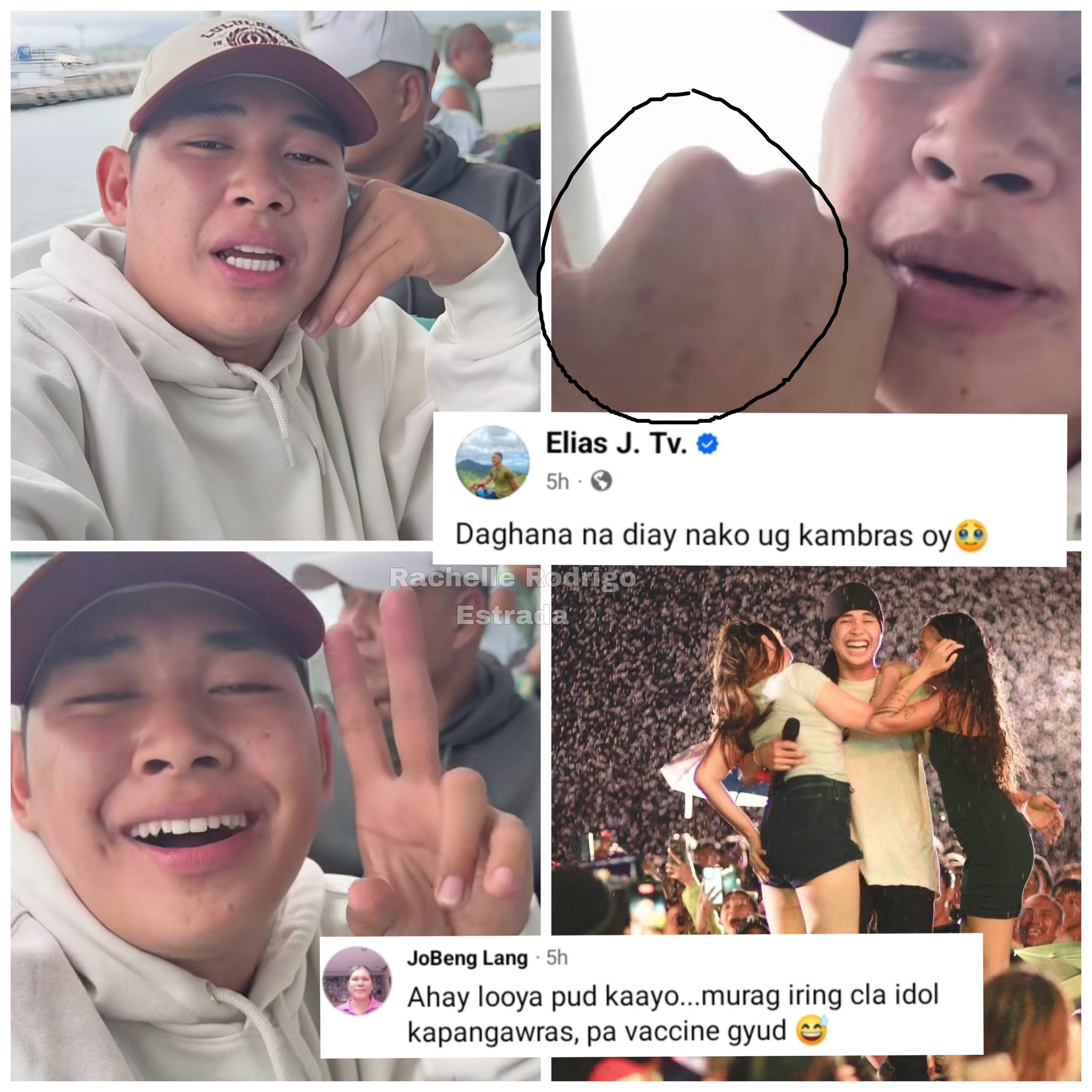 Rachelle - Elias J Tv napansin nga Niya na marami na pala siyang Kalmot ...