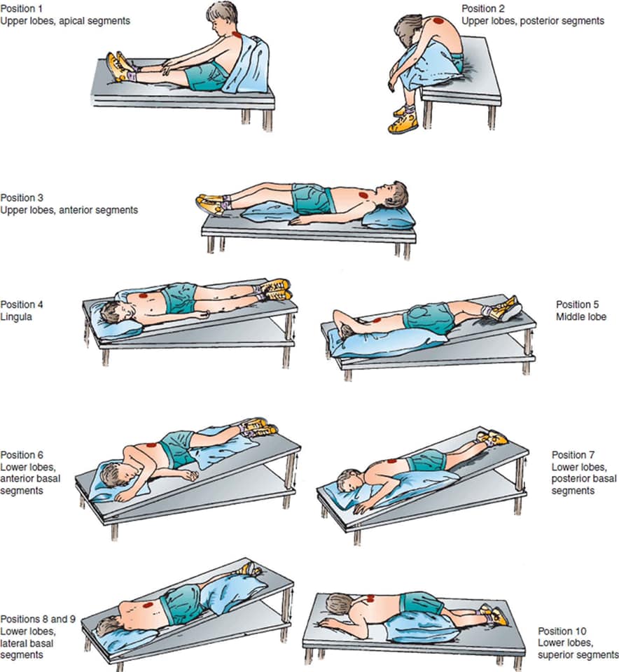 Postural Drainage Positions Pdf