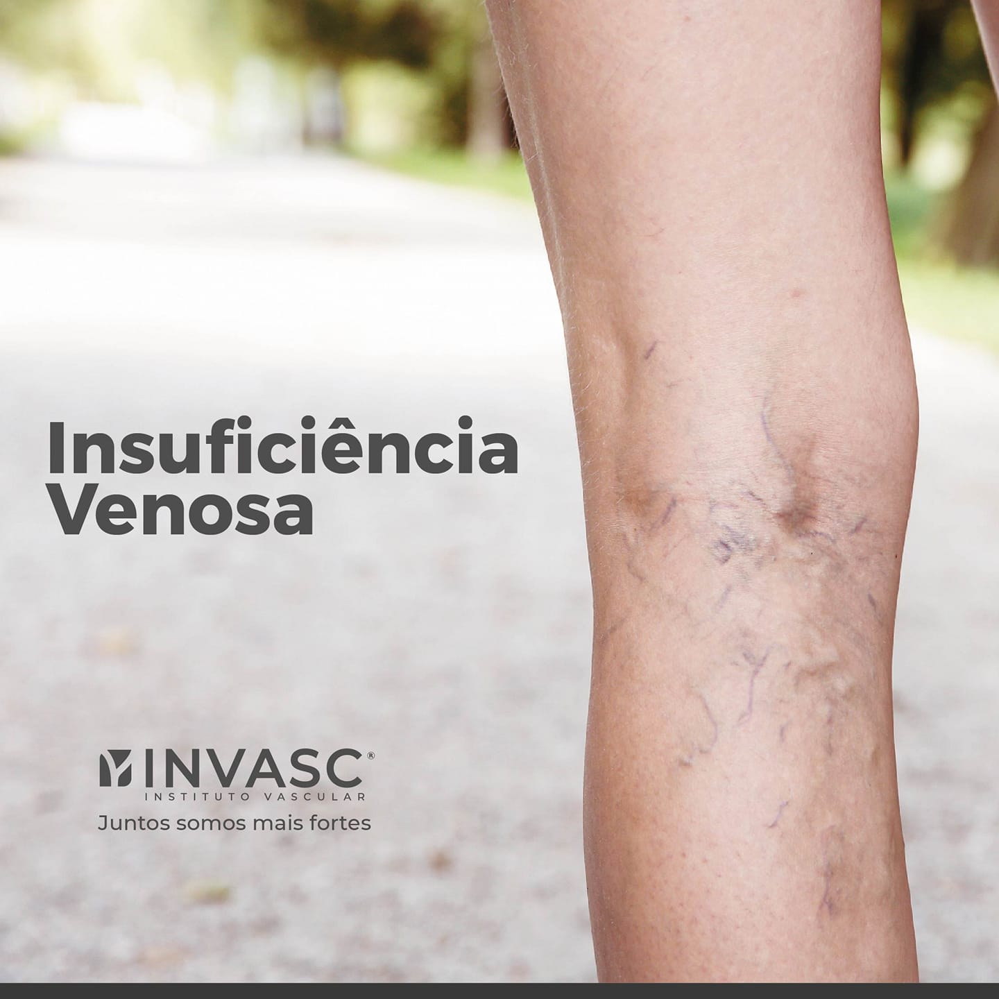 Insuficiência venosa crônica... - Invasc - Instituto Vascular | Facebook