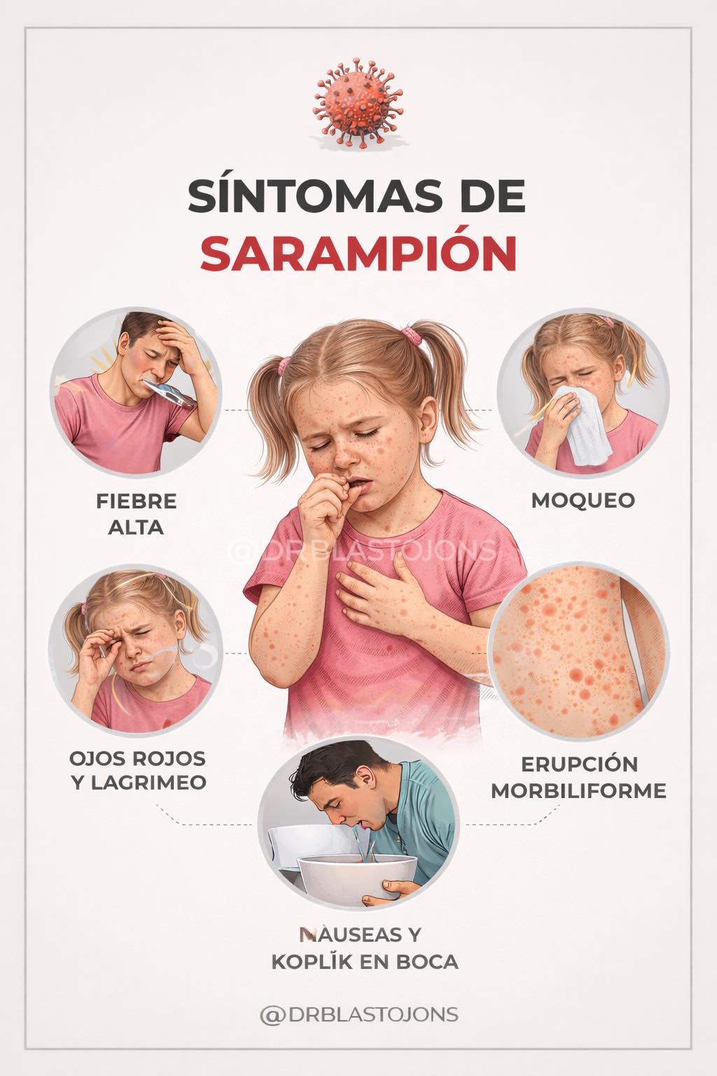 Dr - SÍNTOMAS DEL SARAMPIÓN: NO ES UNA SIMPLE “RONCHITA” El sarampión ...