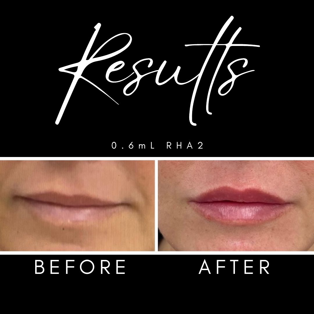 We are so pleased... - G I L L I E Aesthetics & Dermatology
