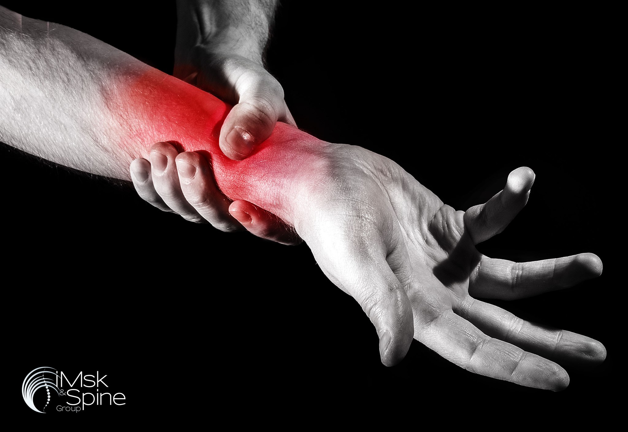 Carpal Tunnel Syndrome is a... - The IMSK & Spine Group