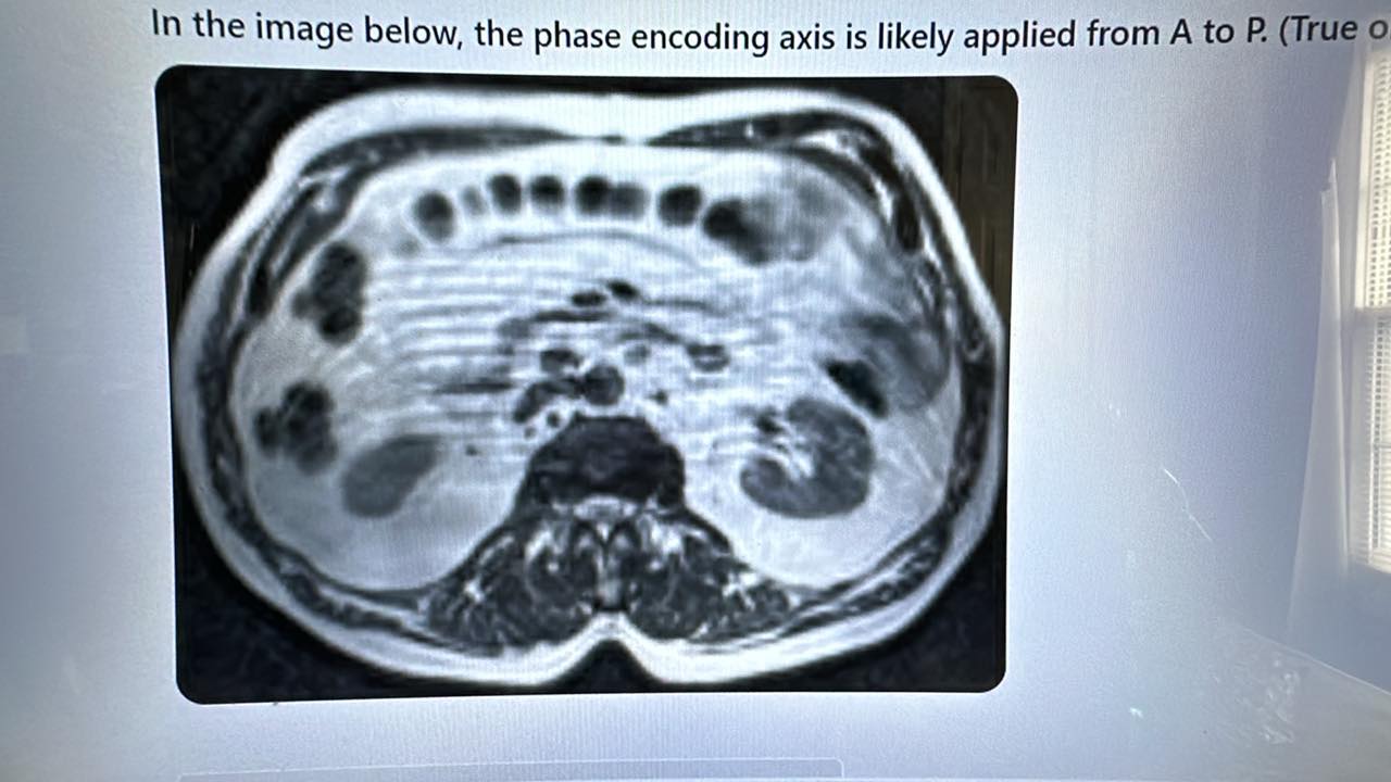 MRI Knowledge Base | How can you tell when phase encoding is r/l or a/p ...