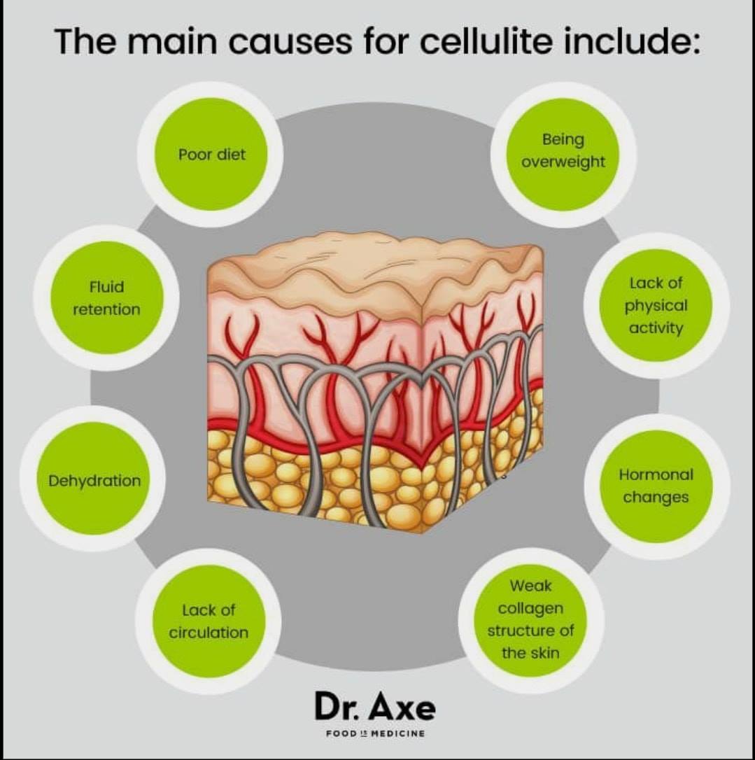 What do you know about cellulite? - Ahvia Beauty and Wellness