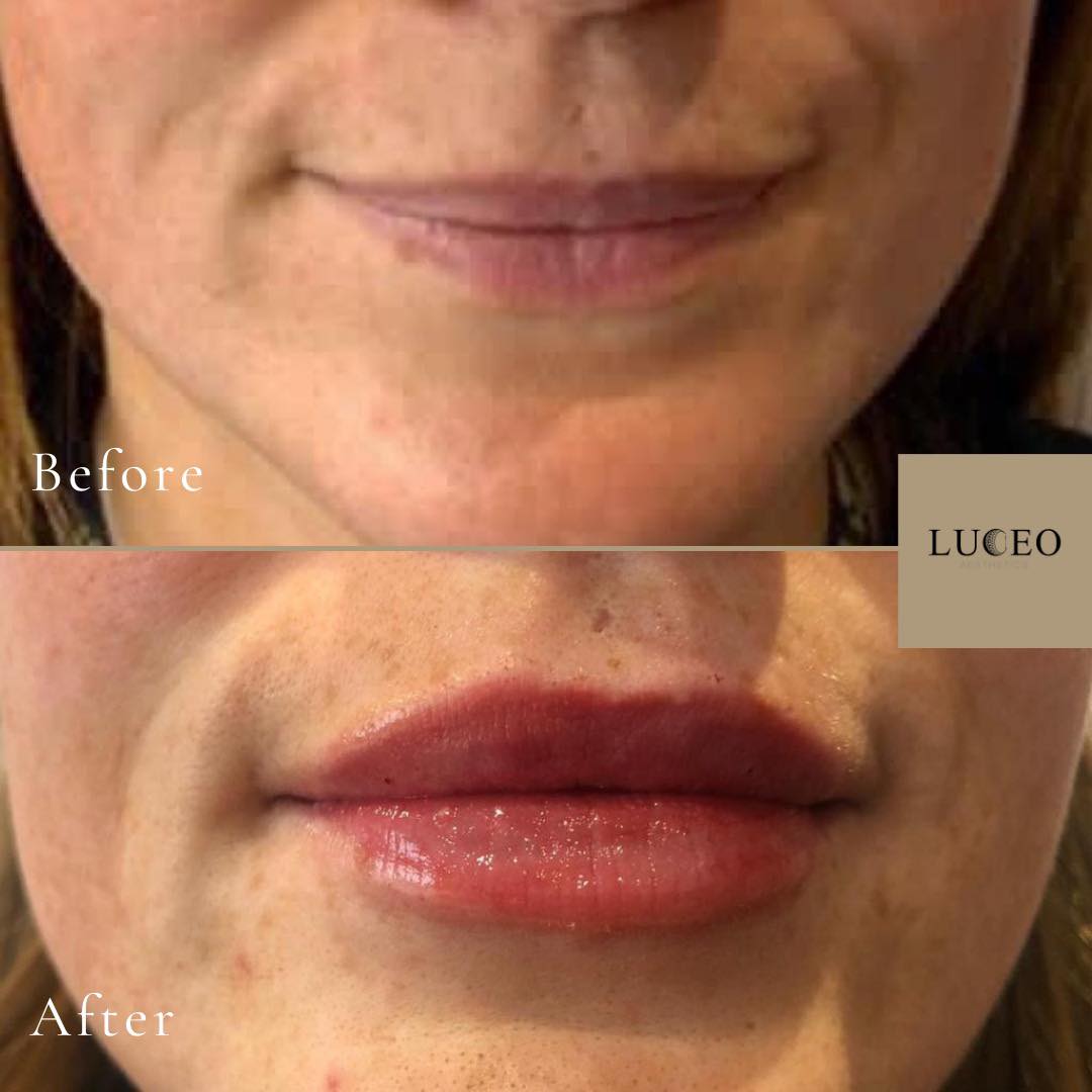 Luceo Aesthetics Home Facebook