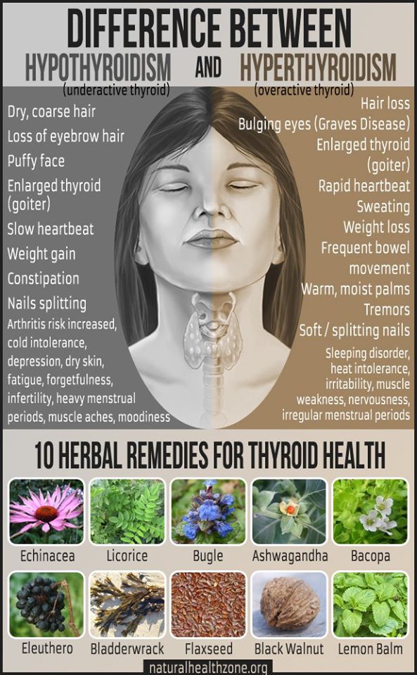 Promag300 Ultraproactive Philippines Did You Know That When Thyroid Hormone Production Drops Your Body S Processes Slow Down And Change Hypothyroidism Can Affect Many Different Systems In Your Body Hypothyroidism Can Affect
