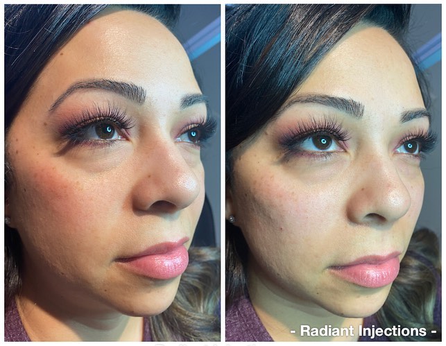 The perfect combo for this beautiful... - Radiant Injections