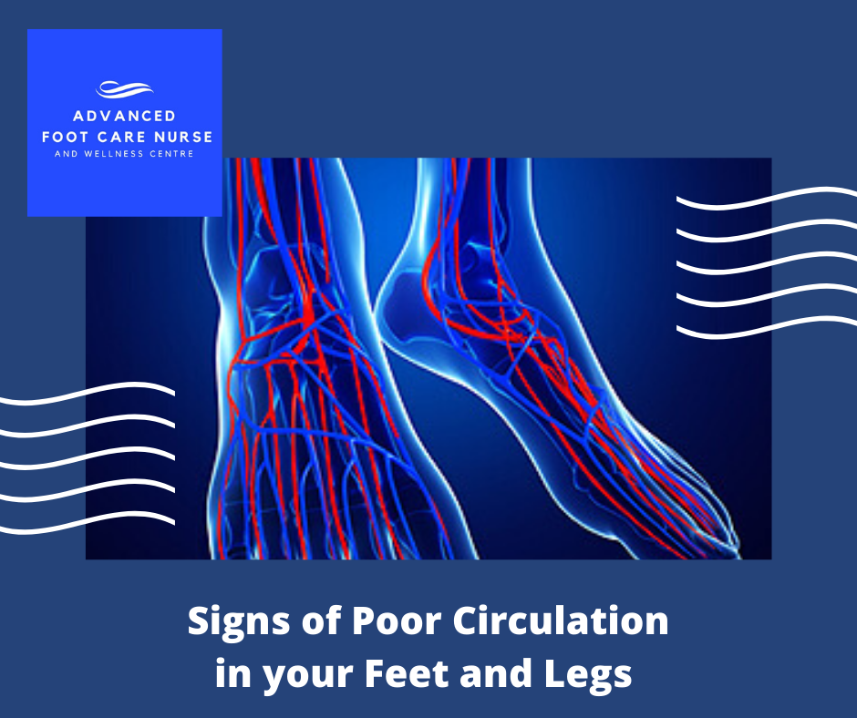 Advanced Foot Care Nurse and Wellness Centre Inc. - Signs and Symptoms ...