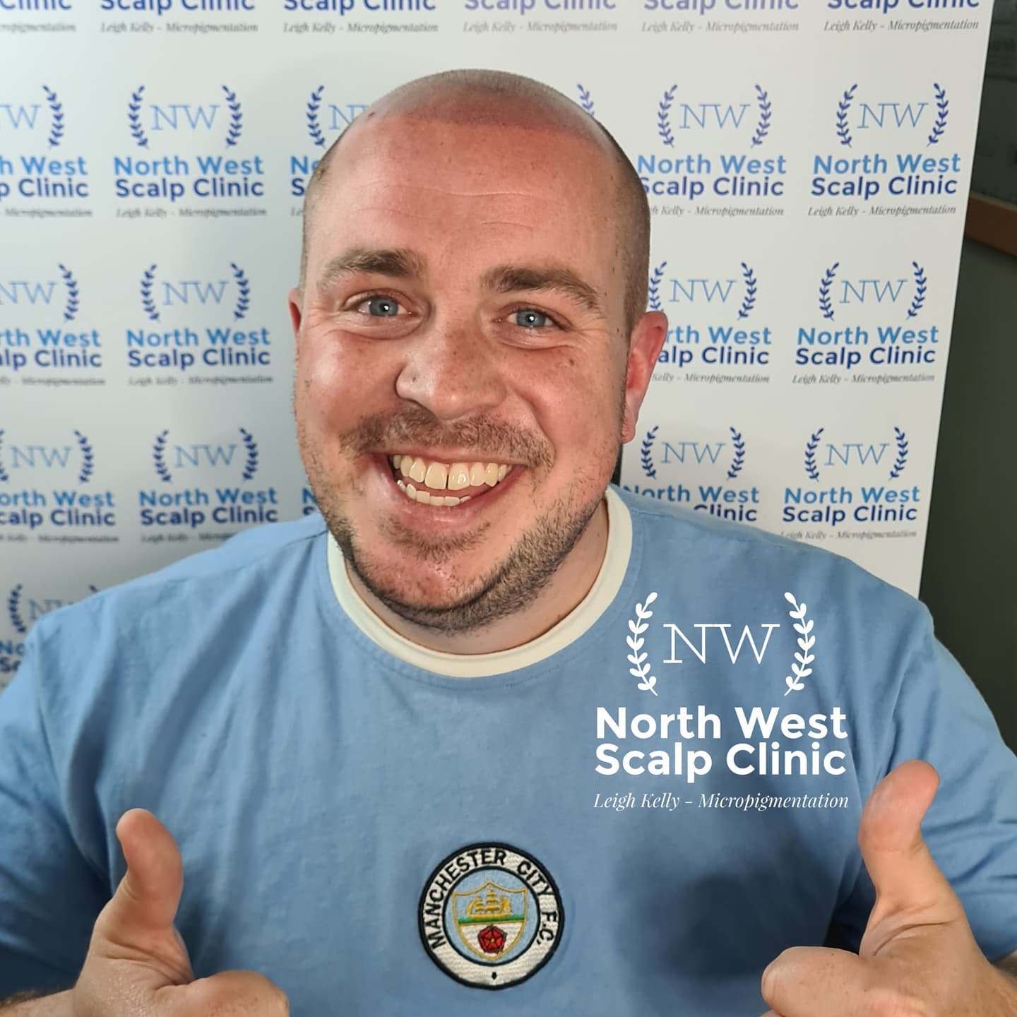 The best... - North West Scalp Clinic & Training Academy