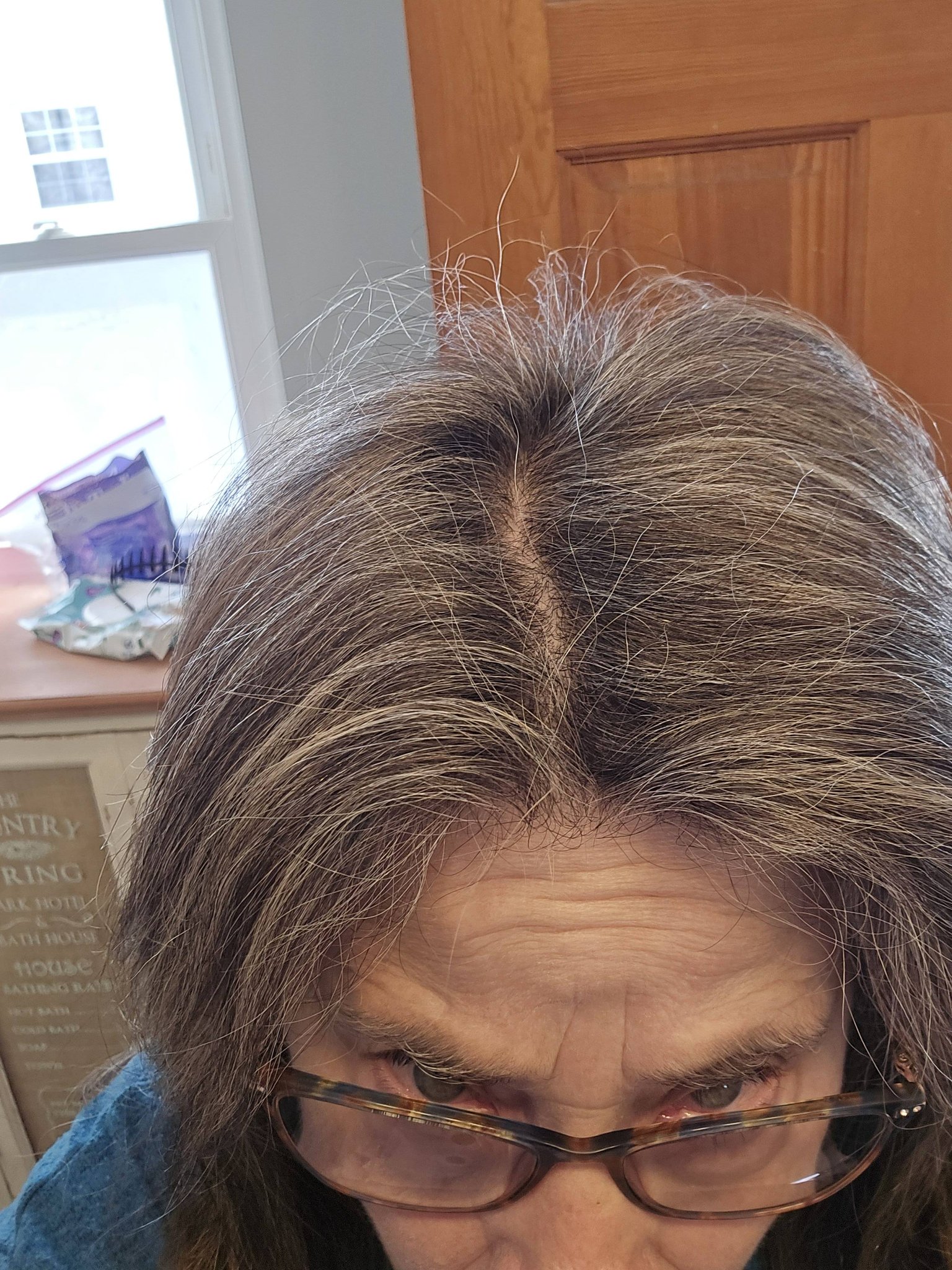bpc 157 human case report clinical trial BPC-157 And TB-500: Background, Indications, Efficacy, And Safety GlobalRPH Size x Gauge x Needle Length:3cc 25g x 5/8