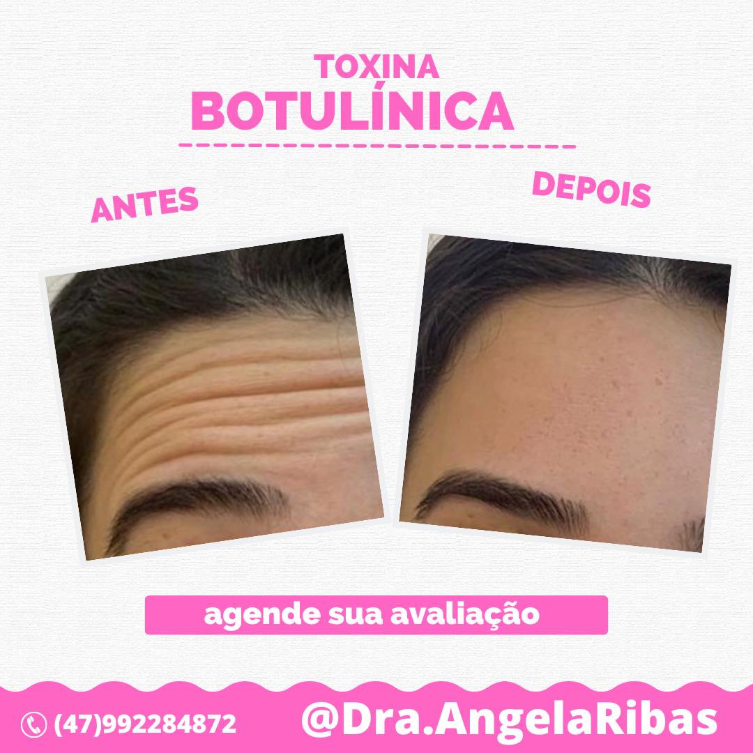 Dra. Ângela Ribas-Fisioterapia e Estética | Tijucas SC