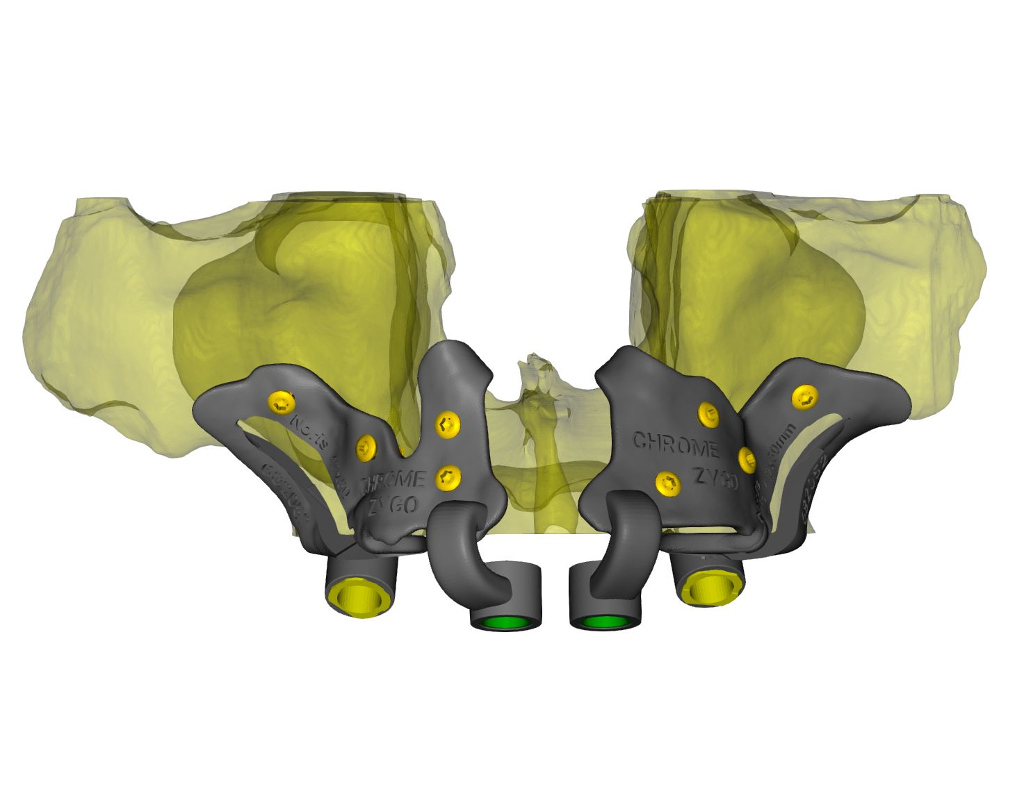 Grammetry - the IOS Alternative to Dental Photogrammetry | Facebook