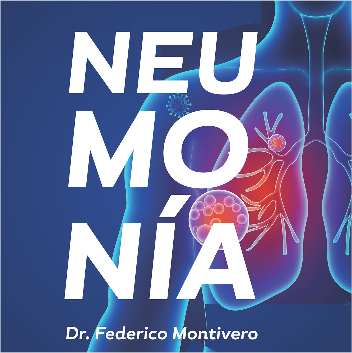 Qué es la NEUMONÍA, cuáles... - San Agustin Medicina Laboral