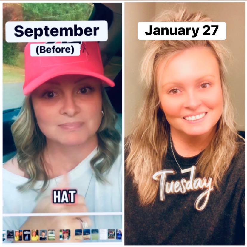 ghk-cu injections for thicker hair?
