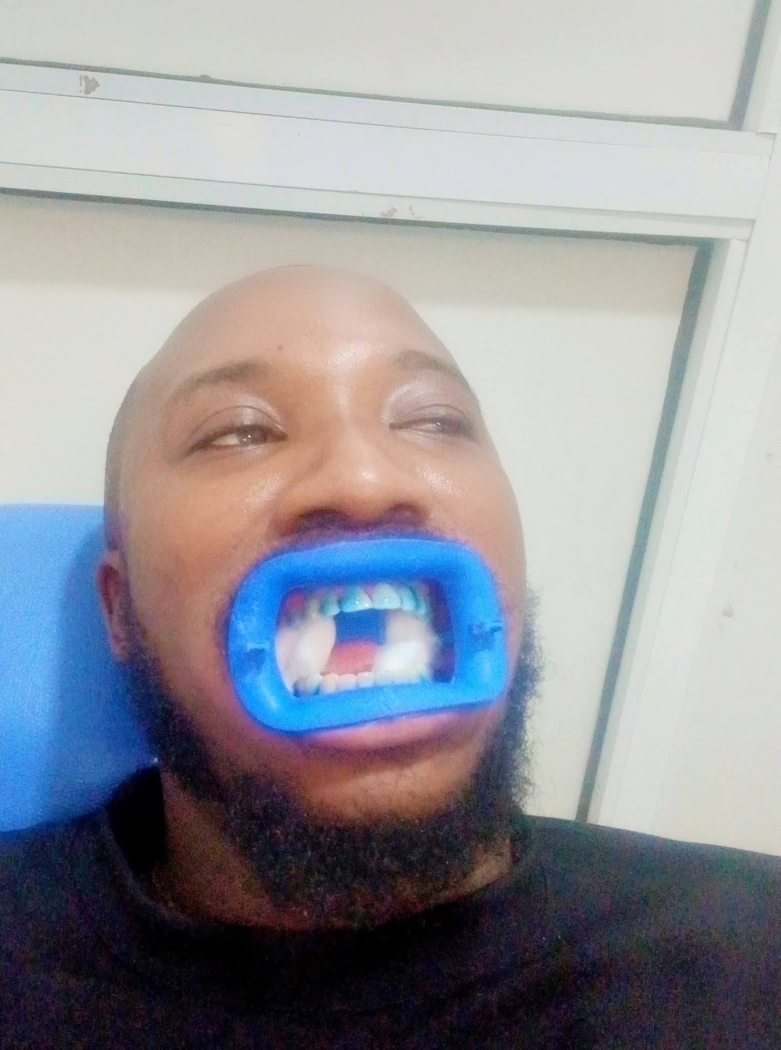 Worlds Biggest Human Tooth US Man Sets World Record For Tongue As Big