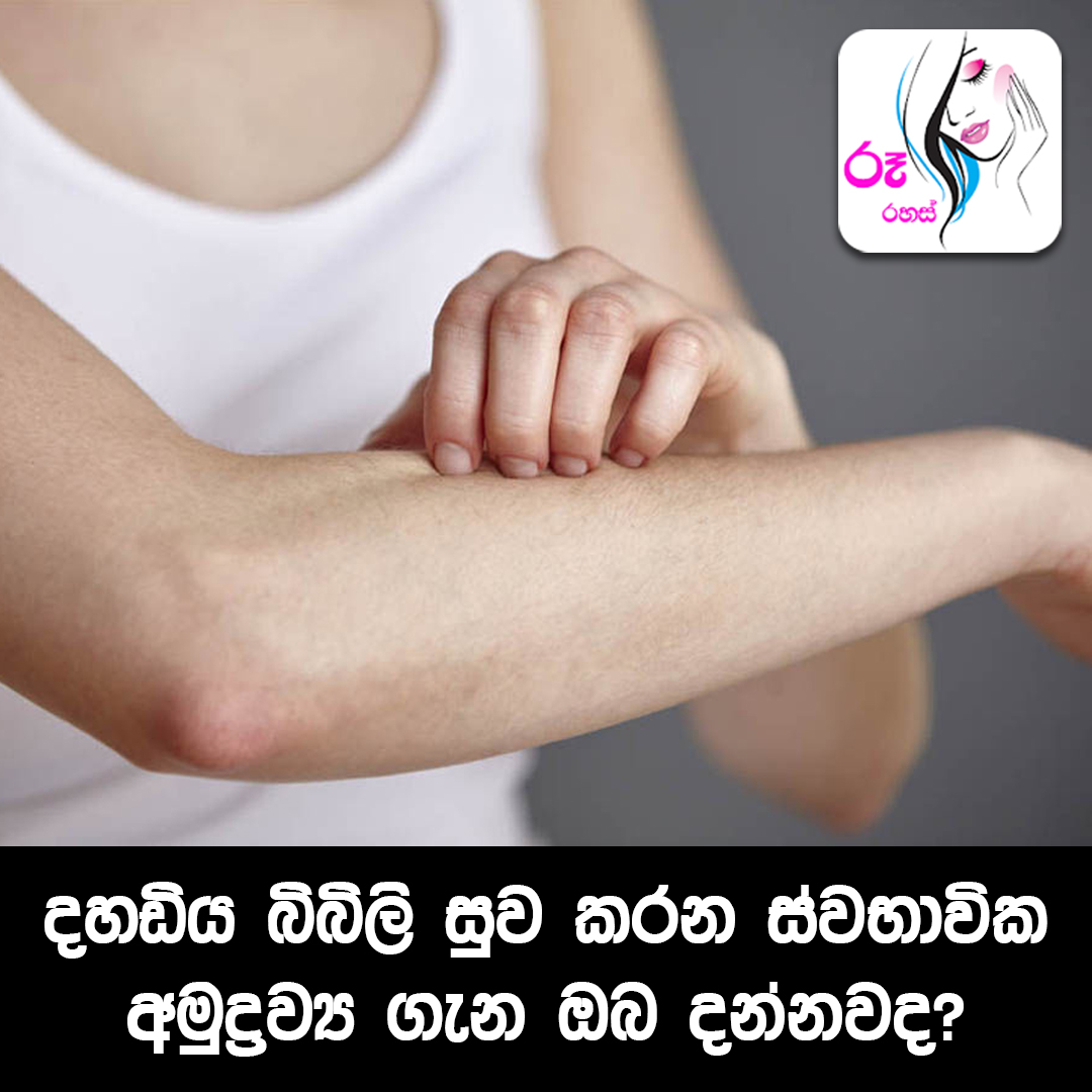 Ru Rahas - දහඩිය බිබිලි සුව කරන ස්වභාවික අමුද්‍රව්‍ය ගැන... | Facebook