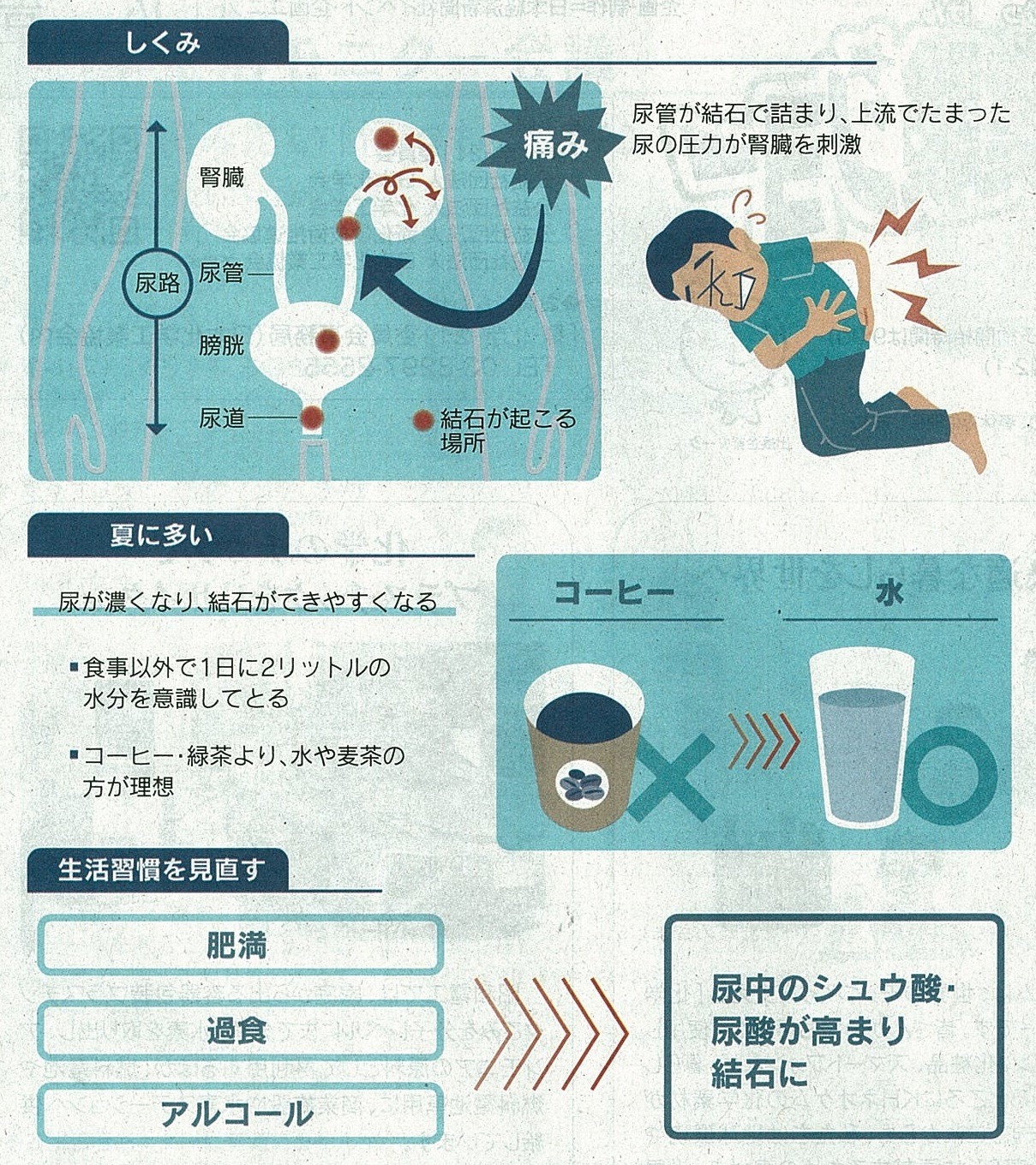 吉村やすのり 生命の環境研究所 尿路結石発症の増加 尿路結石とは 腎臓から尿道に至る尿路に 尿 中のカルシウムやシュウ酸などの成分が固まってできる石のことを言います 腎臓にできる場合もあれば 膀胱にできるケースもあります このうち 腎臓と膀胱をつなぐ 尿管