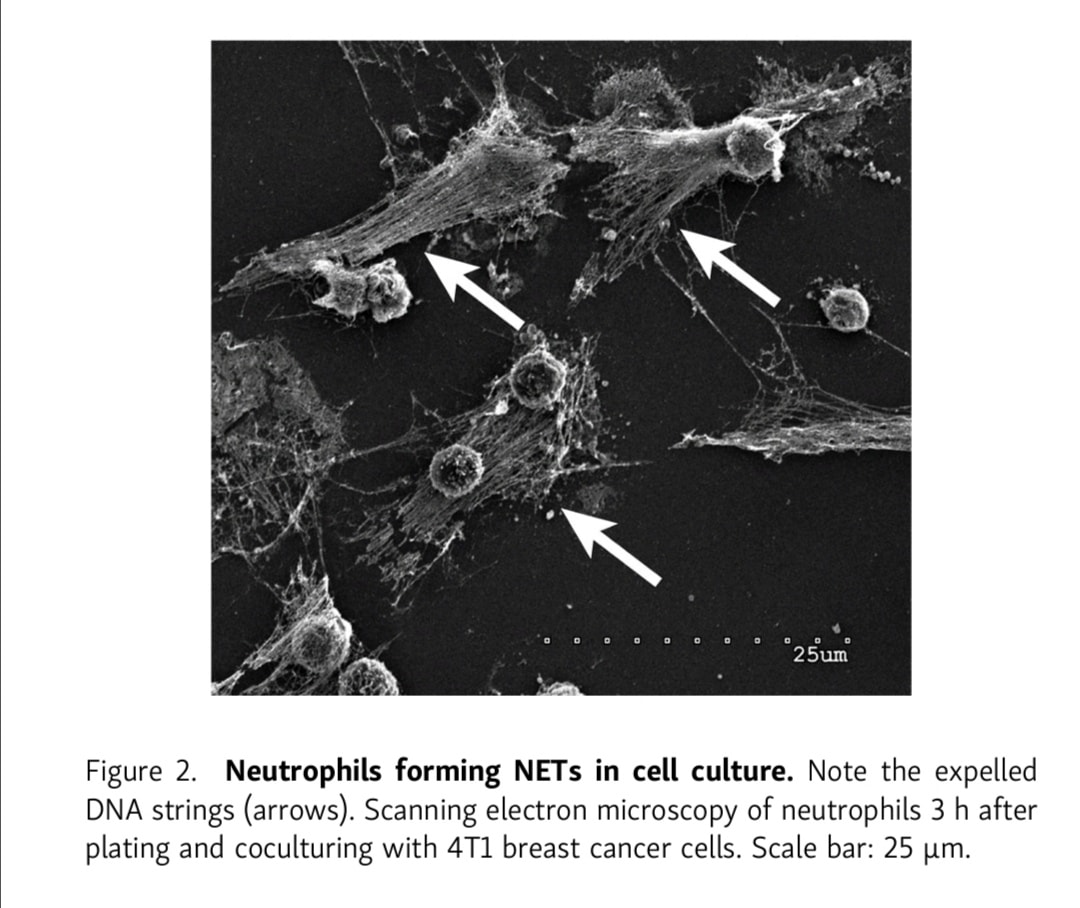 🧐🔎 🕸 Targeting potential drivers of COVID-19: Neutrophil extracellular ...