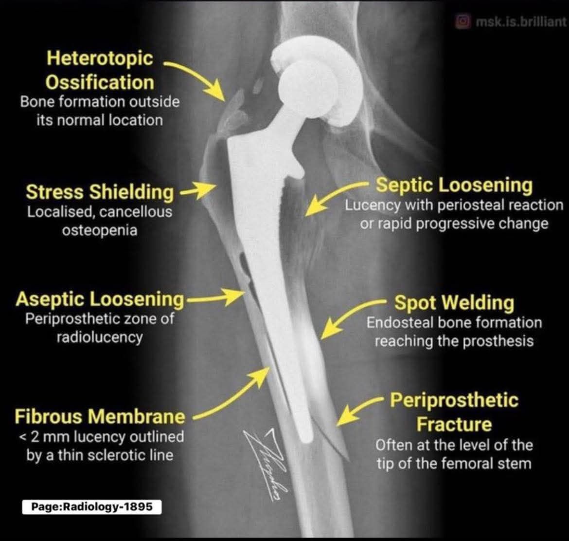 Radiology ( X-Ray ) | Identify the X-ray finding | Facebook