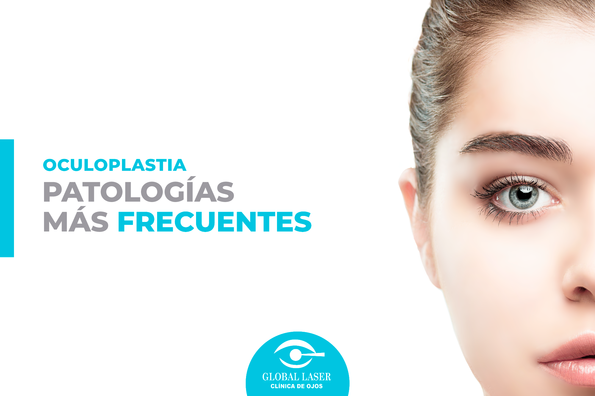 Gracias a la oculoplastia... - Clínica de Ojos Global Laser