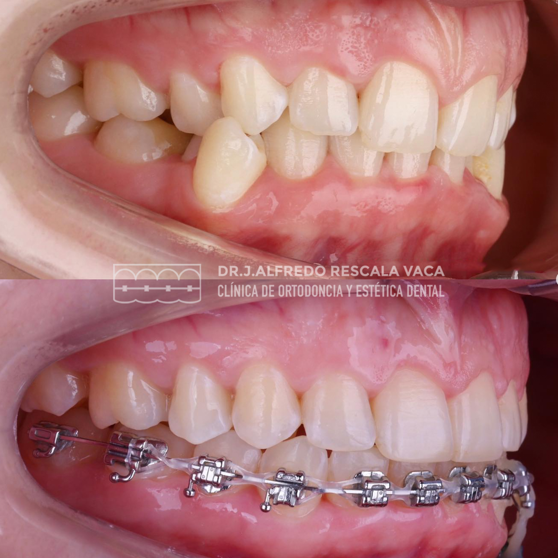🦷 Descubre el Estuche de... - Dr. J. Alfredo Rescala Vaca | Facebook