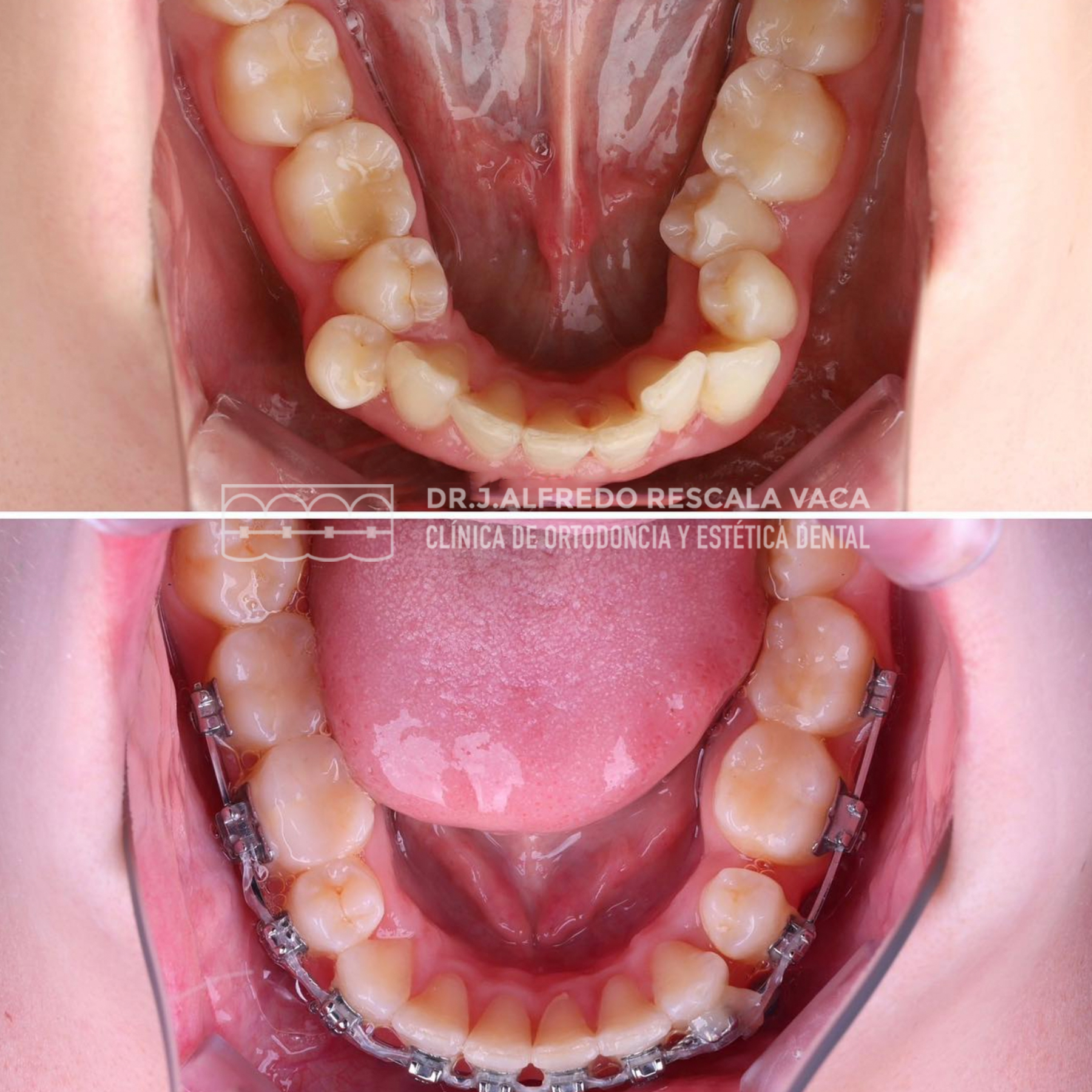 🦷 Descubre el Estuche de... - Dr. J. Alfredo Rescala Vaca | Facebook