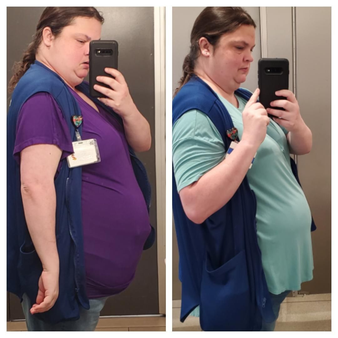 I've lost an additional -50lbs with the help of Semaglutide from WeightCare managing my insulin resistant PCOS💛 Use the link in my bio and my discount code 'SAM99' to save on your