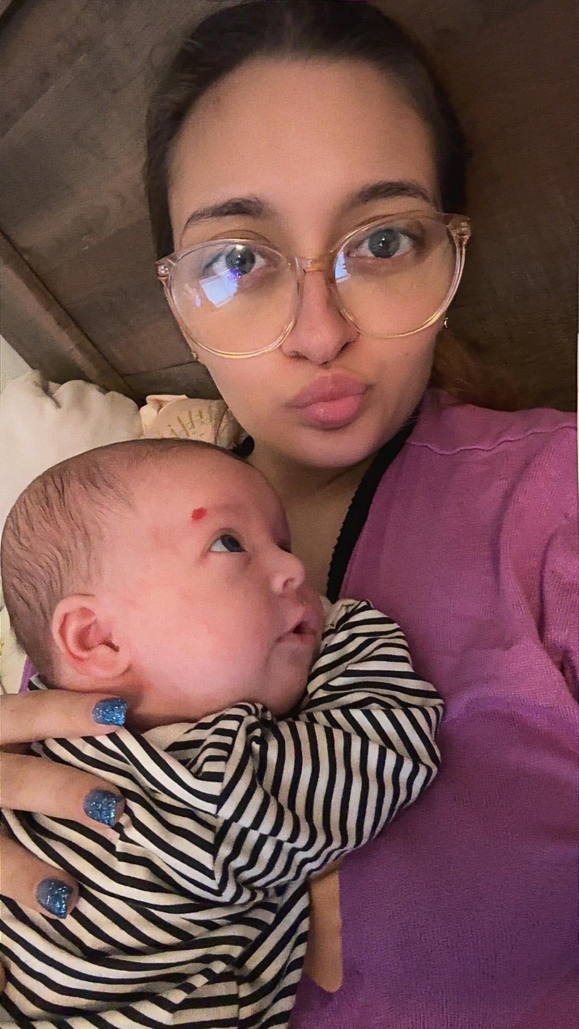 Joesmarie - The start of ailanis strawberry birthmark It was so tiny at ...