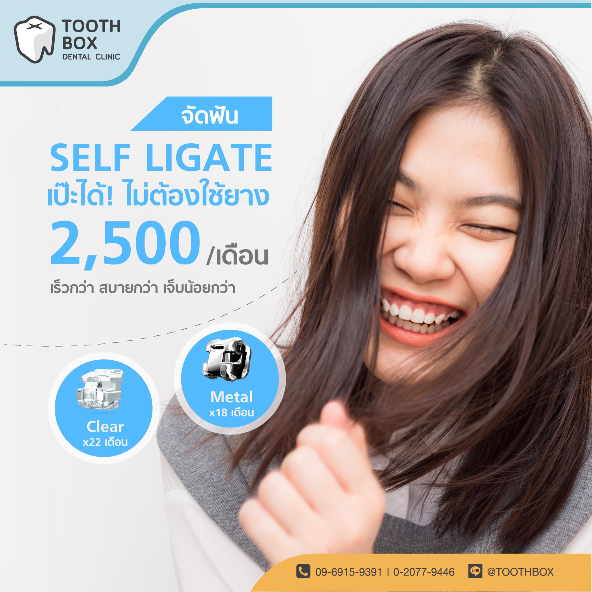 Tooth - 📣 จัดฟัน SELF LIGATE ก็ดีน๊าา อีกหนึ่งทางเลือกของการจัดฟันแบบ ...