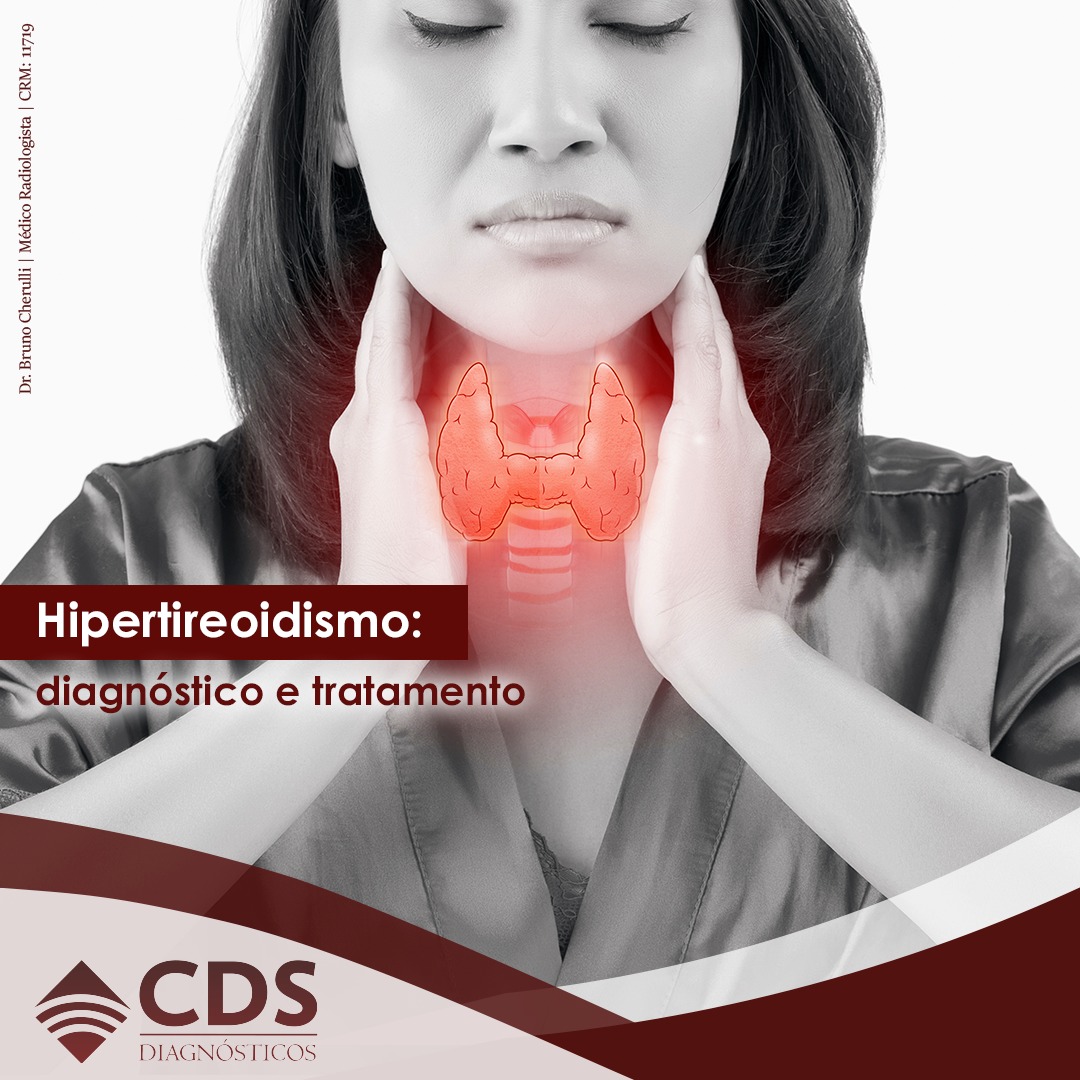 🧐 Você sabe o que é hipertireoidismo?... - CDS Diagnósticos | Facebook