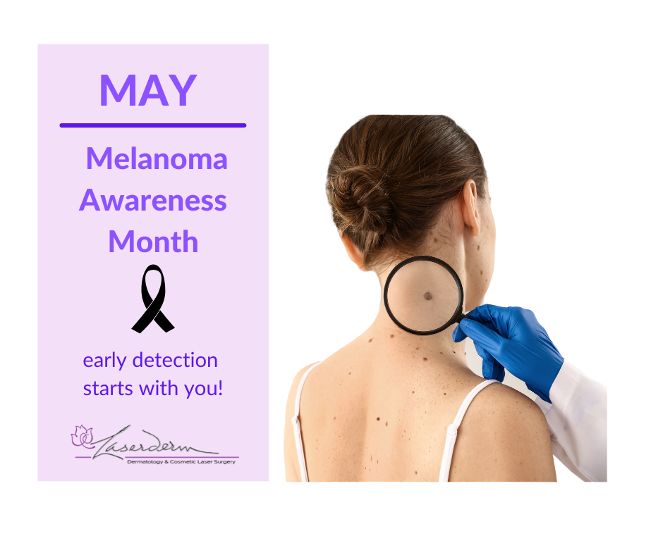 May is Melanoma Awareness Month 🖤... - Laserderm Dermatology