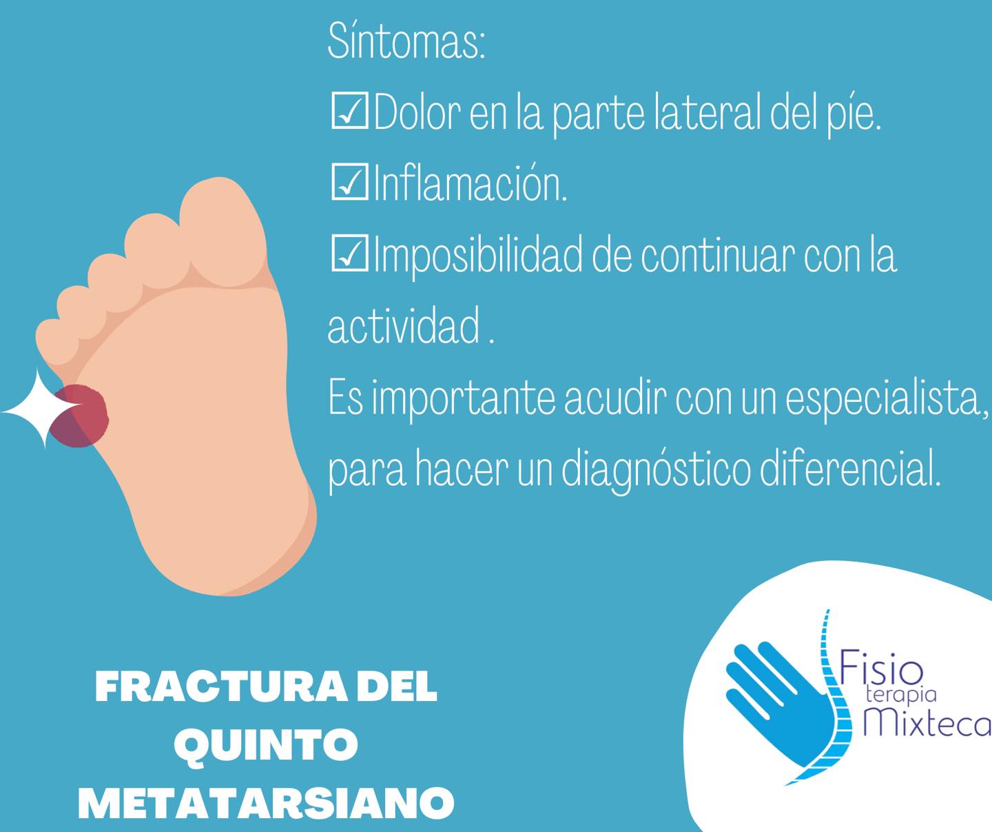 Dolor En El Quinto Metatarsiano