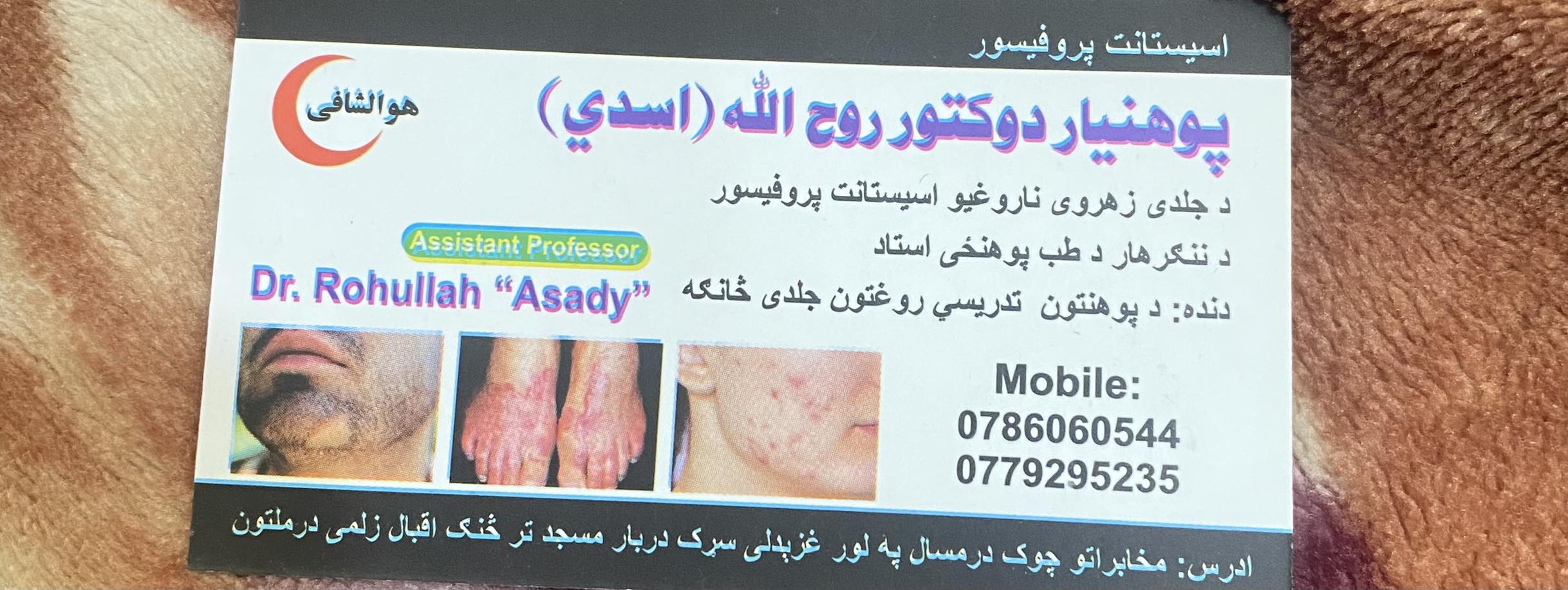 Dr: Rohullah Asady Dermatology & Aesthetic Clinic | Jalalabad