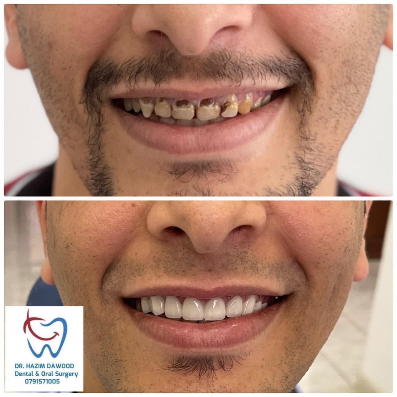 Al-Rashdan Dental Lab | Irbid