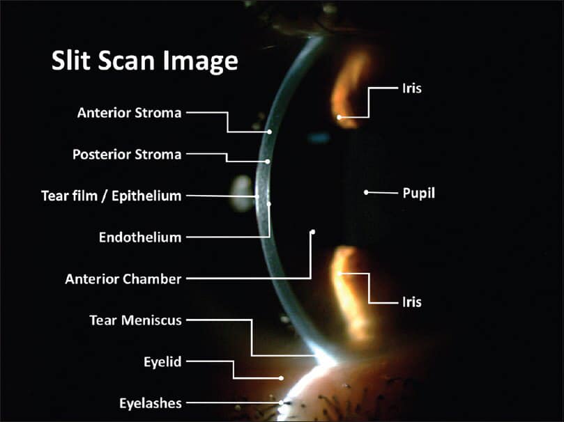 Ophthalmo gallery