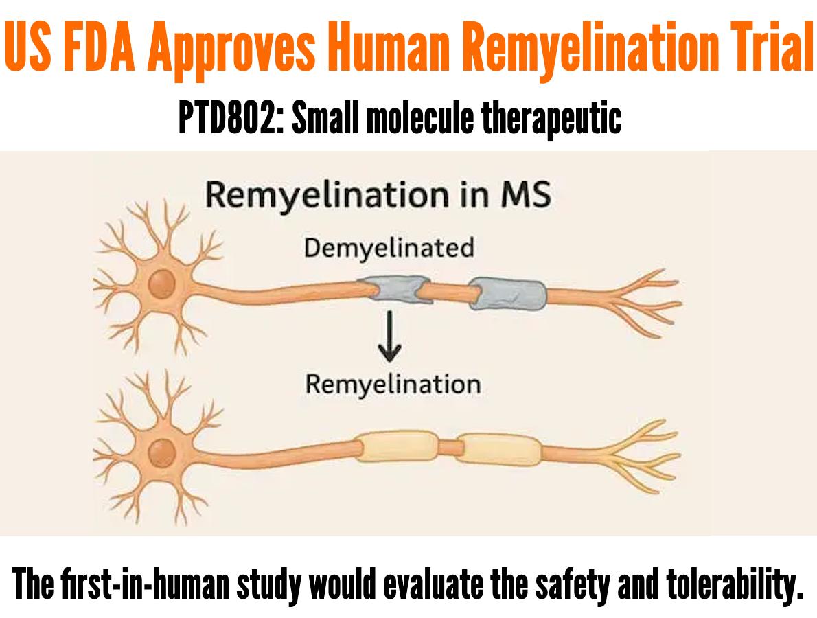 bpc 157 remyelination A newly discovered molecule is showing real promise in helping repair myelin, the protective layer that surrounds your nerves. In conditions like multiple sclerosis, the immune system damages this layer, which disrupts B12 by SeeBeyond Medicine 5-amino Size:100 ML