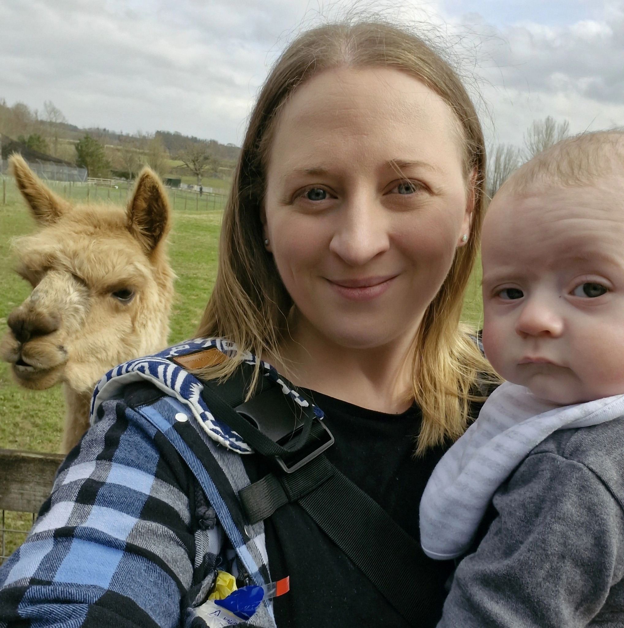 Positional Plagiocephaly Talk / Helmets/ Cranial Bands/ Torticollis ...