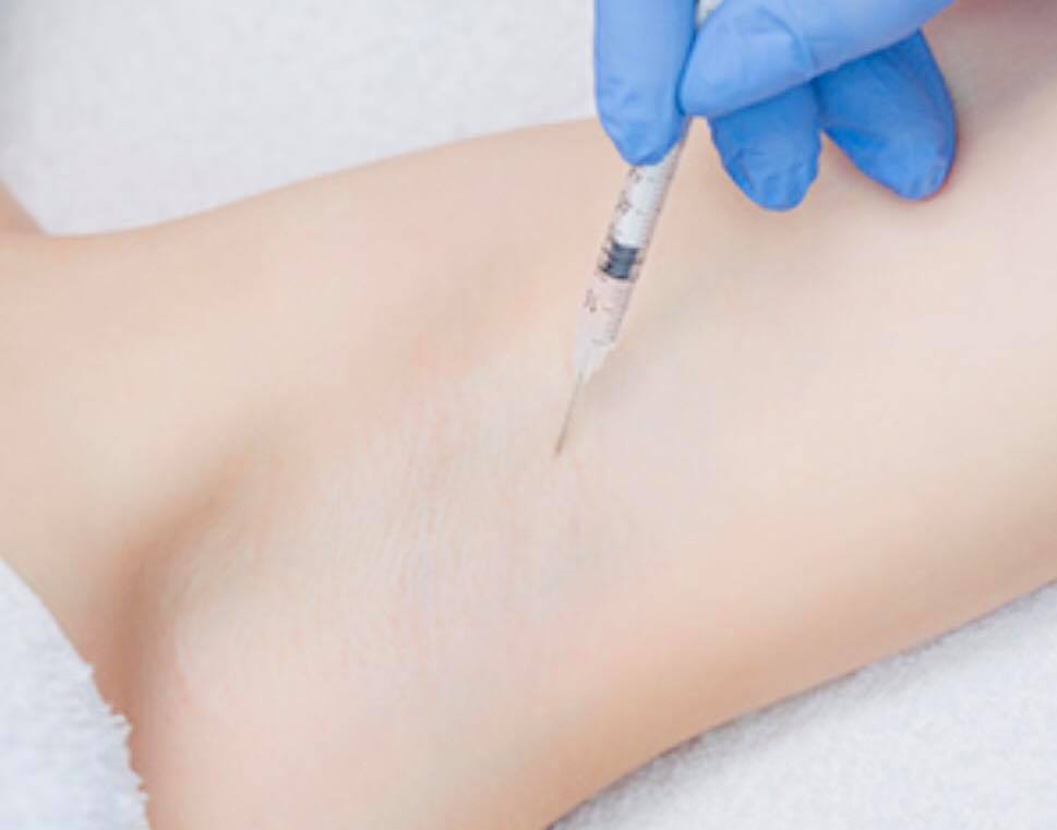 בוטוליניום... - Dr. Efrat Solomon Cohen - Dermatologist