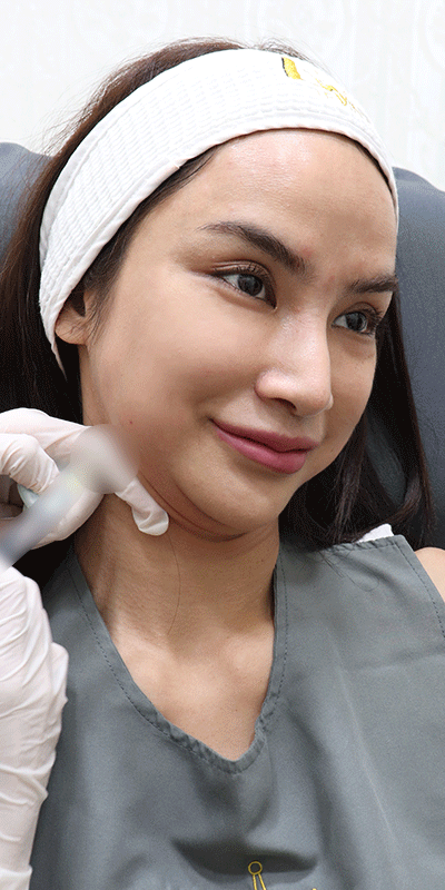LE VINCE clinic - #รีวิวหลังสลายไขมัน Meso fat เหมาขวด 👉...