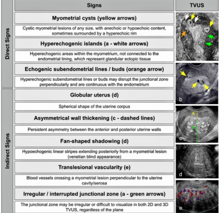 Radiology - This image is a classic summary of transvaginal ultrasound ...