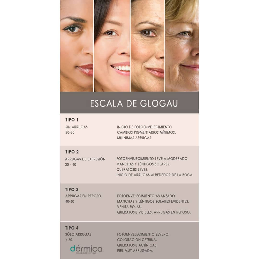 Dérmica - ¿Sabes qué es la escala de Glogau? 🍂 • La escala de Glogau se ...