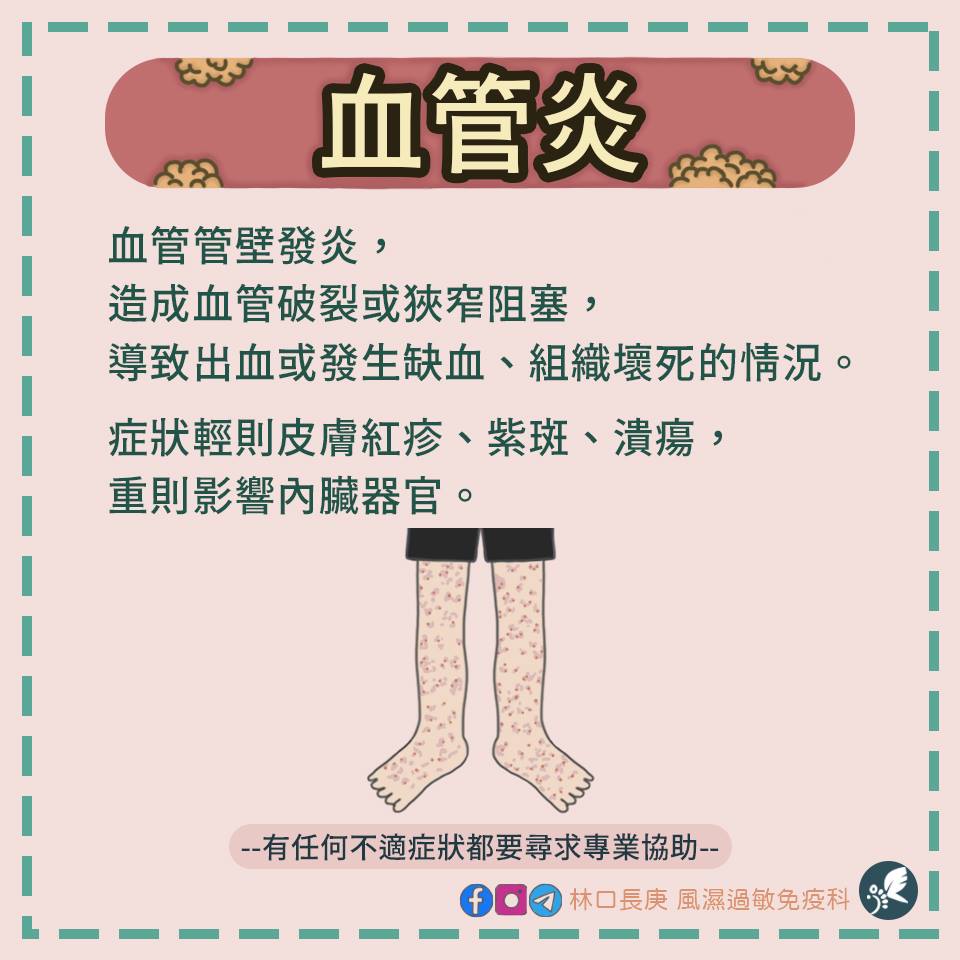 林口長庚風濕過敏免疫科 - 什麼是血管炎呢 ️ 血管管壁發炎， 造成血管破裂或狹窄阻塞，💥💥... | Facebook