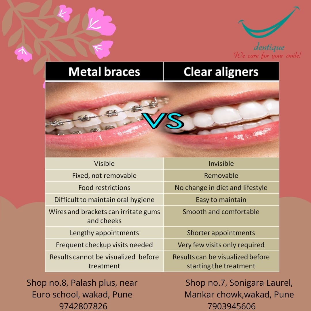 Dentique - Difference between braces and aligners is clear... | Facebook