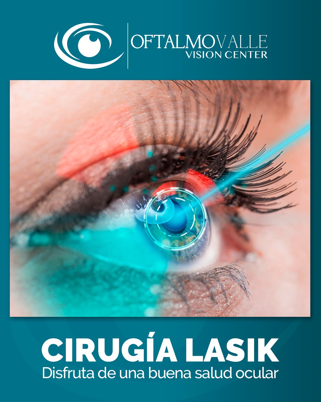 🔵CIRUGÍA LASIK‼️ Es la cirugía... - Clínica Oftalmovalle | Facebook